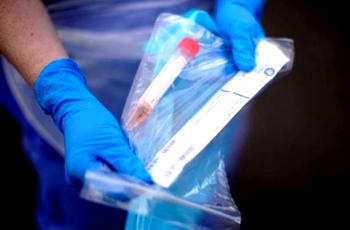 WHO can’t prove coronavirus was made in laboratory ― China