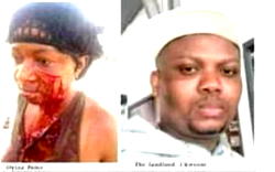 Landlord, wife slit tenant’s face over unpaid rent in Lagos
