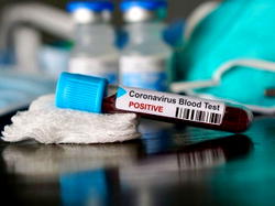 COVID-19: Why we haven’t been conducting massive community testing – FG