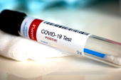 Coronavirus: We have tested over 3 million since April — Wuhan