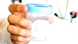 Coronavirus detected in semen of infected men ―Chinese study