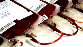 Money in exchange for blood should be discouraged – NBTS