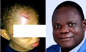 Reps member offers scholarship to little girl abused by uncle