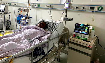 Doctor whose skin turned dark during coronavirus fight dies