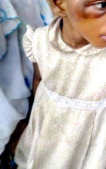 Child Abuse: Oyo govt arrests man for torturing 7-yr old daughter