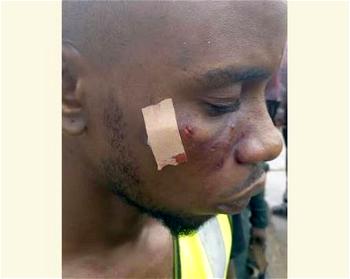 4 injured as Okada operators, thugs clash over daily levy, loading units in Abia