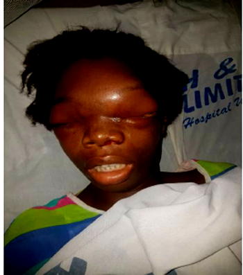 UPDATED: Help my daughter out of this pain, mother of ailing girl begs Nigerians