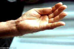 Court sentences man to 15 yrs for cutting-off uncle’s wrist