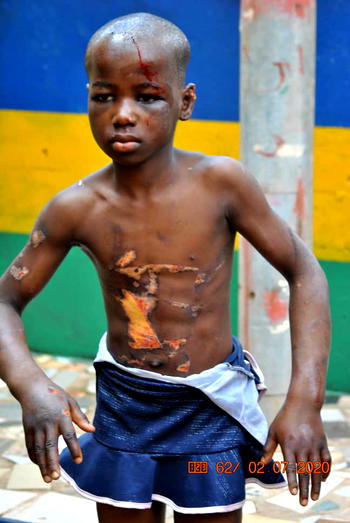 Lifeline as LG Chair moves to secure abused Enugu girl’s future