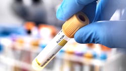 21 million Nigerians suffering from viral hepatitis infection  ― Commission