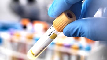 Sepsis accounts for over 11m preventable deaths, says Global Alliance