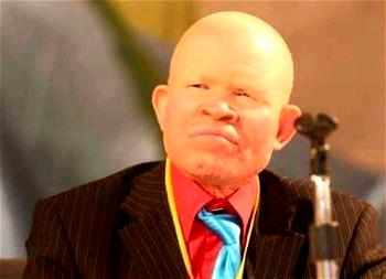 DR Congo’s albino wrestling hero dies at 54