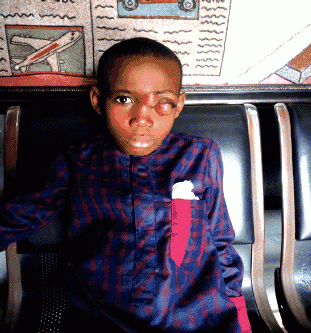 Jobless father cries out: Lack of funds, threat to my son’s recovery from cancer