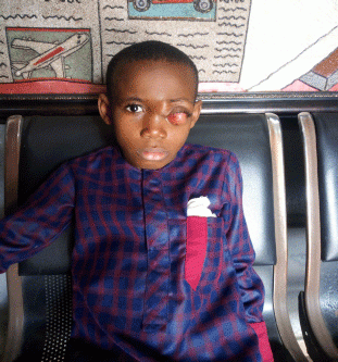 Jobless father cries out: Lack of funds threat to my son’s recovery from cancer
