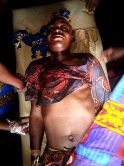 Man goes into coma after hit by Customs’ stray bullet in Ogun 
