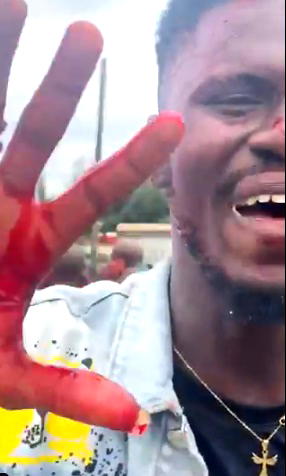 Bloody protest in Benin as thugs attack #EndSARS protesters