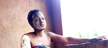 Kerosene Explosion: Women, 70, 21, inflicted with serious severe burns in Ebonyi