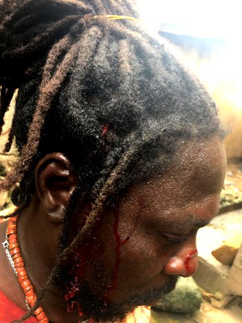 #EndSARS: Panic as hoodlums attack protesters in Osogbo again