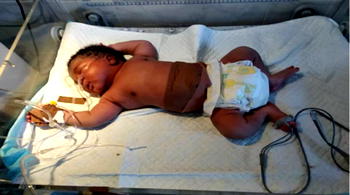 SOS: Baby Shalom seeks N7.5m for corrective heart surgery
