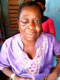 GRAPHIC PHOTOS: 65-year-old woman attacked in Delta over land dispute