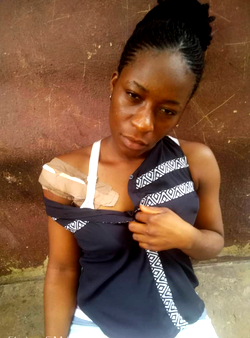 Uniport student shot by robbers thanks rescuers