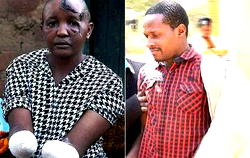 Man chops off wife’s hands for failing to bear him children