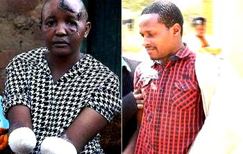 Man chops off wife’s hands for failing to bear him children