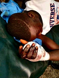 Herder attacks 58-yr-old man, son over missing cow in Bayelsa