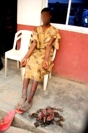 NSCDC rescues Abia girl chained on the neck by mother
