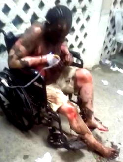 Woman goes berserk, sets sister, three others on fire over inheritance