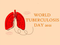 World TB Day: 20,522 TB patients missing in Kano — Commissioner