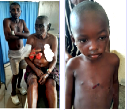 Survivors relive ordeal after armed militias wreak havoc in Benue IDPs camp, kill 7, injure many