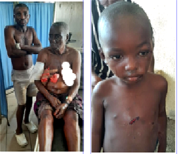 Survivors relive ordeal after armed militias wreak havoc in Benue IDPs camp, kill 7, injure many