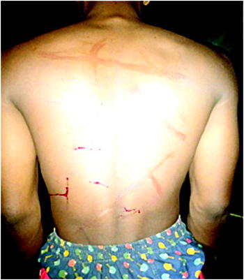‘My boss tortured me comatose over N50 airtime, N200 panadol’
