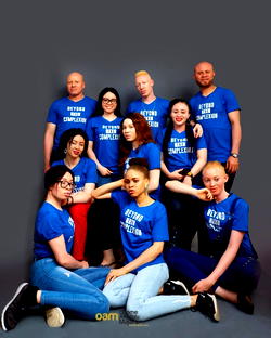 World Albinism Day: OAM Foundation, LASODA decry discrimination against albinos
