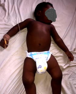 Baby needs N1.5m for surgery