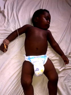Baby needs N1.5m for surgery