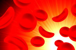 Cost of treatment hampering management of sickle cell disease – Stakeholders