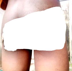 GRAPHIC: Ex-Air Force officer’s wife torture juvenile orphan with hot iron, starvation