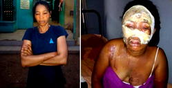 Mother of 2 pours hot water on husband’s alleged girlfriend during church vigil in Ogun