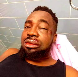Photos: Mr Raw survives auto crash in Abuja