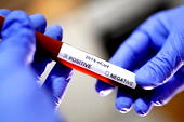 COVID-19: Nigeria should be ready for more variants, if…. — Experts