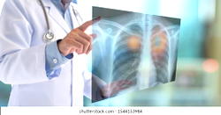 Brain drain hits Radiography profession as 5 leave Nigeria every week