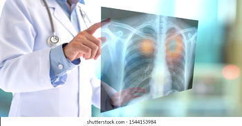 Brain drain hits Radiography profession as 5 leave Nigeria every week
