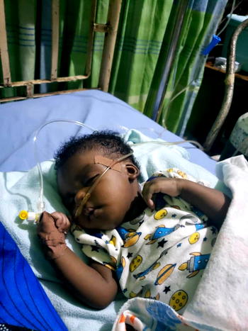Two-month-old baby needs N16m for corrective surgery