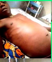 Badmus, 33, seeks N11m for urgent liver transplant