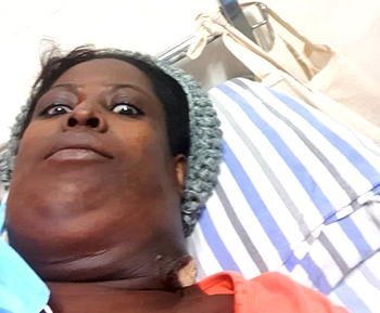 Victoria, cancer patient seeks N25m for bone marrow transplant