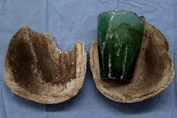 Glass tumbler found in woman’s bladder 4 years after she used it as s3x toy