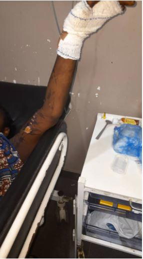 Teenager in distress after co-worker poured hot oil on her
