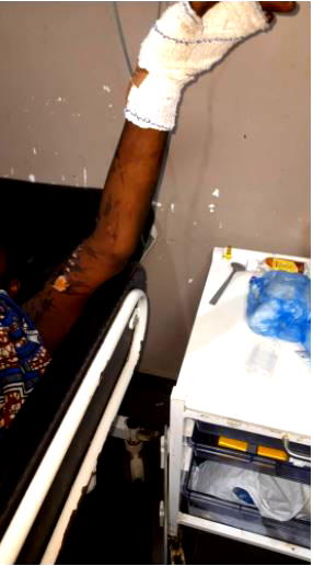 Teenager in distress after co-worker poured hot oil on her